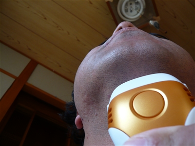 脱毛ビフォー&アフター