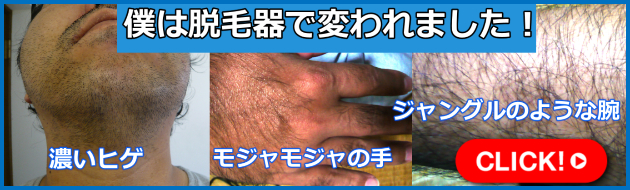 男性用脱毛器おすすめランキング【ヒゲ、胸毛、スネ毛にも効果的な人気脱毛器とは】
