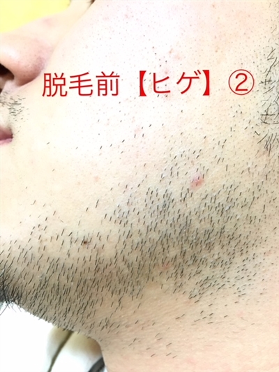 _ђEь̕ώA܂܂茩ꂸ