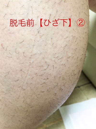 _ђEь̕ώA܂܂茩ꂸ