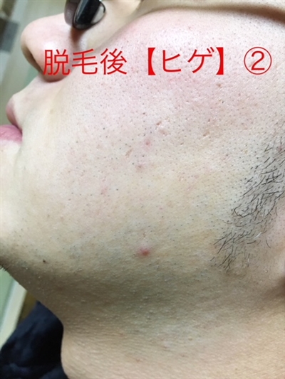 _ђEь̕ώA܂܂茩ꂸ