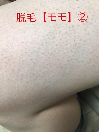 _ђEь̕ώA܂܂茩ꂸ